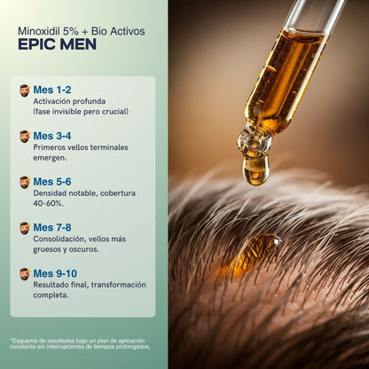 Minoxidil EPIC MEN - Cabello y Barba 30 ml