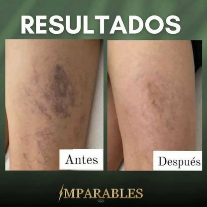 GEL DE MASAJES CASTAÑAS DE INDIA