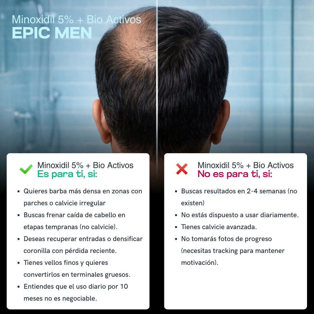 Minoxidil EPIC MEN - Cabello y Barba 30 ml