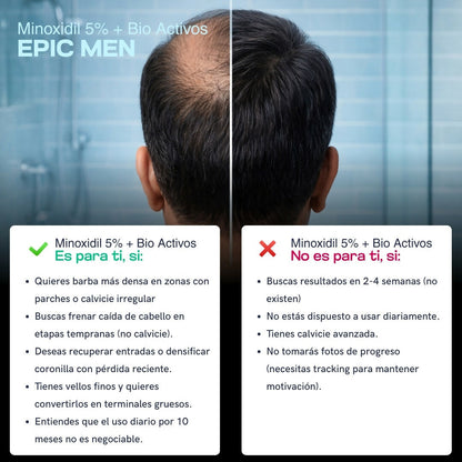 Minoxidil EPIC MEN - Cabello y Barba 30 ml